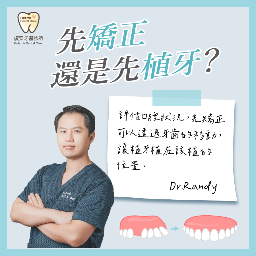 復安牙醫診所 -- 先矯正還是先植牙 好呢？